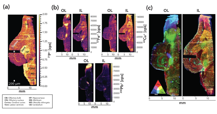 Малюнок 2. Лазерна абляція МС-ІЗП зображень осьового зрізу репрезентативних мізків білок з Внутрішнього (IL) і Зовнішнього (OL) Лондона з роздільною здатністю 40 мкм.
