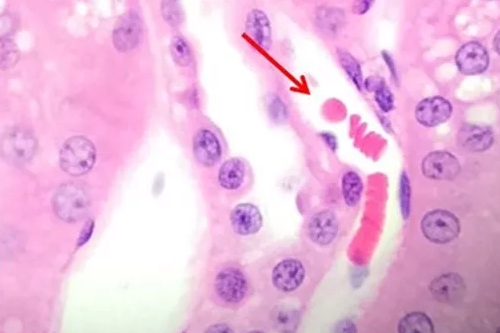 Мал.3.  Ядра на цьому зображенні контрастують  із цитоплазмою та еритроцитами у кровоносній судині. Зверніть увагу на інтенсивність еритроцитів порівняно з рожевим кольором цитоплазми навколишніх клітин.