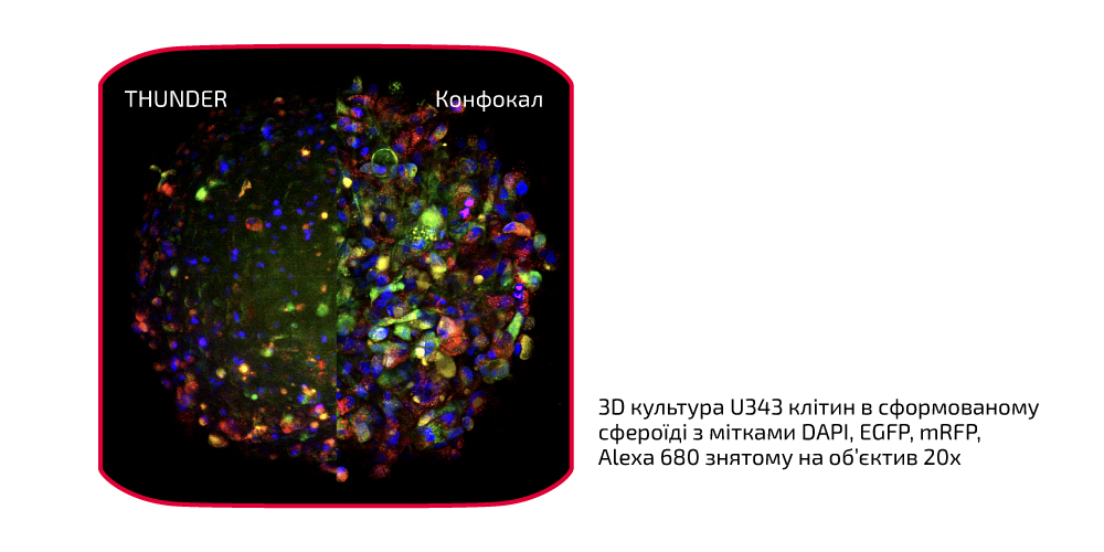 3D культура U343 клітин в сформованому сфероїді з мітками DAPI, EGFP, mRFP, Alexa 680 знятому на об’єктив 20х