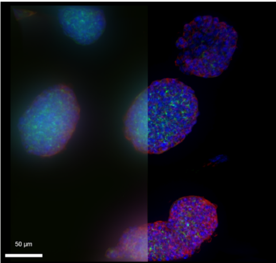 Зображення 2: Клітини MIN6, вирощені у вигляді псевдоострівців (бета-клітини підшлункової залози). DAPI (синій), Інсулін (Alexa488, зелений), мембранний рецептор (Alexa594, червоний), фалоїдин (Alexa647, білий). Зразок наданий доктором Ремі Боннавіоном, Інститут досліджень серця і легенів імені Макса Планка, Бад Наухайм (Німеччина).