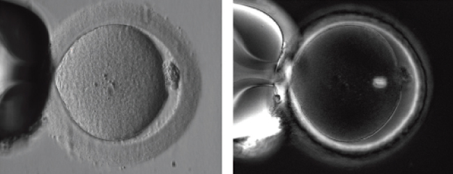На звичайному контрастному зображенні ооцита MII людини (ліворуч), зробленому безпосередньо перед ICSI, такі структури, як веретено поділу і численні шари zona pellucida залишаються невидимими. На зображенні Oosight (праворуч) чітко видно, що веретено поділу має гарну бочкоподібну форму, і всі три шари zona pellucida є видимими.